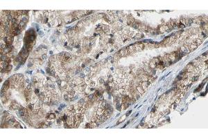 ABIN6272607 at 1/100 staining Human prostate tissue by IHC-P. (PIK3C2G Antikörper  (C-Term))