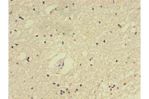 Immunohistochemistry (IHC) image for anti-E2F Transcription Factor 2 (E2F2) (AA 1-83) antibody (ABIN7172517)