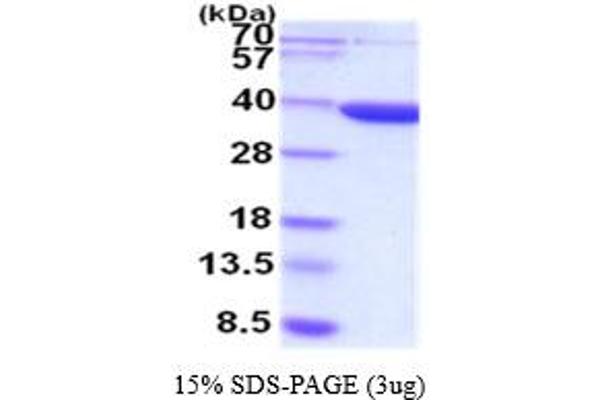 AKR7A3 Protein (AA 1-331)