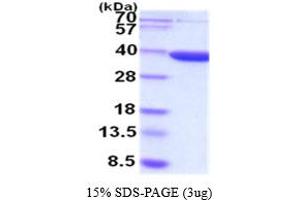 SDS-PAGE (SDS) image for Aldo-Keto Reductase Family 7, Member A3 (Aflatoxin Aldehyde Reductase) (AKR7A3) (AA 1-331) (Active) protein (ABIN5854494) (AKR7A3 Protein (AA 1-331))