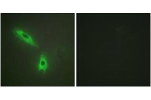 Immunofluorescence analysis of HeLa cells, using TNFC Antibody. (LTB Antikörper  (AA 181-230))