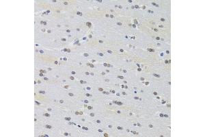 Immunohistochemistry (Paraffin-embedded Sections) (IHC (p)) image for anti-PRP3 Pre-mRNA Processing Factor 3 Homolog (PRPF3) (AA 1-280) antibody (ABIN6146260)
