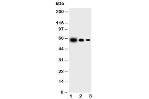 Western blot testing of IL23 p19 antibody and Lane 1:  recombinant mouse protein 10ng (IL23A Antikörper  (N-Term))