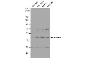 Western Blotting (WB) image for anti-Homer Homolog 1 (HOMER1) (Center) antibody (ABIN2855600)