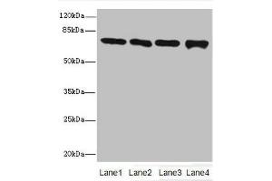 Western blot All lanes: Protein-arginine deiminase type-2 antibody at 16 μg/mL Lane 1: PC-3 whole cell lysate Lane 2: Hela whole cell lysate Lane 3: Mouse brain tissue Lane 4: MDA-MB-231 whole cell lysate Secondary Goat polyclonal to rabbit IgG at 1/10000 dilution Predicted band size: 76, 50 kDa Observed band size: 76 kDa (PADI2 Antikörper  (AA 1-665))
