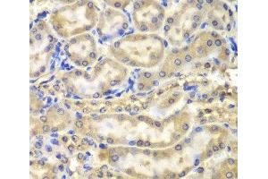 Immunohistochemistry of paraffin-embedded Mouse kidney using Myelin Basic protein Polyclonal Antibody at dilution of 1:200 (40x lens).