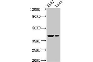 Western Blot Positive WB detected in: K562 whole cell lysate, Rat lung tissue All lanes: PTX3 antibody at 2 μg/mL Secondary Goat polyclonal to rabbit IgG at 1/50000 dilution Predicted band size: 42 kDa Observed band size: 42 kDa (PTX3 Antikörper  (AA 99-164))