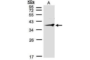 WB Image Sample(30 μg of whole cell lysate) A:MOLT4, 12% SDS PAGE antibody diluted at 1:500 (RNF2 Antikörper  (C-Term))