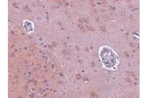 Immunohistochemistry (IHC) image for anti-Family with Sequence Similarity 120A (FAM120A) (Middle Region) antibody (ABIN1030930) (FAM120A Antikörper  (Middle Region))