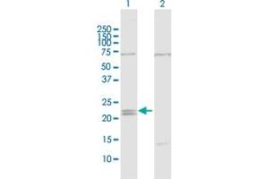 Western Blot analysis of IFNE1 expression in transfected 293T cell line by IFNE1 MaxPab polyclonal antibody. (IFNE Antikörper  (AA 1-208))