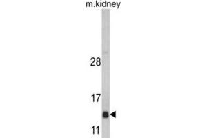 Western Blotting (WB) image for anti-DnaJ (Hsp40) Homolog, Subfamily C, Member 19 (DNAJC19) antibody (ABIN3002676) (DNAJC19 Antikörper)