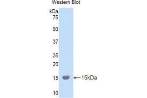 Western blot analysis of the recombinant protein. (LOXL2 Antikörper  (AA 323-427))