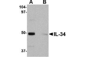 Western blot analysis of IL-34 in human brain tissue lysate with IL-34 antibody at 0. (IL-34 Antikörper  (Center))
