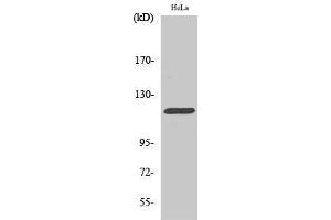 Western Blotting (WB) image for anti-Cas-Br-M (Murine) Ecotropic Retroviral Transforming Sequence (CBL) (Ser207) antibody (ABIN3179912) (CBL Antikörper  (Ser207))