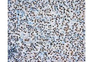 Immunohistochemical staining of paraffin-embedded Kidney tissue using anti-ARNT mouse monoclonal antibody. (ARNT Antikörper)