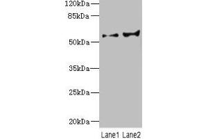 Western blot All lanes: CYP2C18 antibody at 5. (CYP2C18 Antikörper  (AA 231-490))