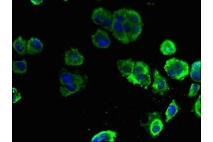 Immunofluorescent analysis of MCF-7 cells using ABIN7151556 at dilution of 1:100 and Alexa Fluor 488-congugated AffiniPure Goat Anti-Rabbit IgG(H+L) (ELOVL1 Antikörper  (AA 82-175))