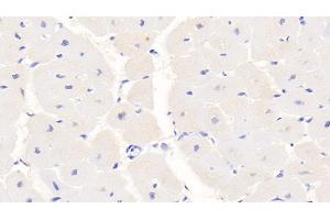 Detection of S100 in Human Cardiac Muscle Tissue using Monoclonal Antibody to S100 Calcium Binding Protein (S100) (S100 Protein (S100) (AA 1-94) Antikörper)