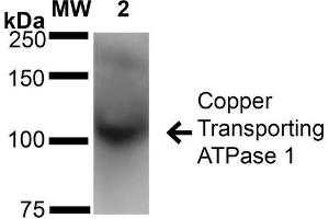Western Blot analysis of Rat Brain Membrane showing detection of ~180 kDa Copper Transporting ATPase 1 protein using Mouse Anti-Copper Transporting ATPase 1 Monoclonal Antibody, Clone S60-4 . (ATP7A Antikörper  (AA 42-61) (Atto 594))