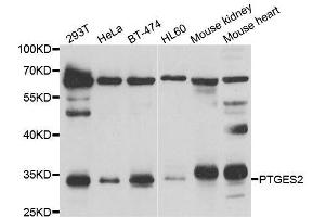 Western blot analysis of extracts of various cell lines, using PTGES2 antibody. (PTGES2 Antikörper  (AA 88-377))