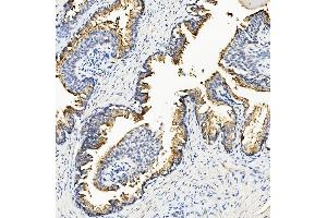 IHC analysis of Ribonuclease Inhibitor/RNH1 using anti-Ribonuclease Inhibitor/RNH1 antibody (ABIN7603117).