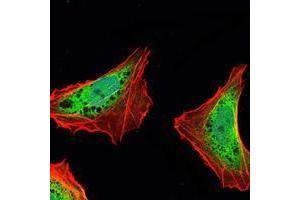 Immunofluorescence analysis of NTERA-2 cells using ATXN1 mouse mAb (green).