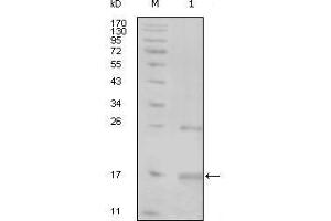 Western Blot showing TNK1 antibody used against truncated TNK1-His recombinant protein (1). (TNK1 Antikörper  (AA 451-560))