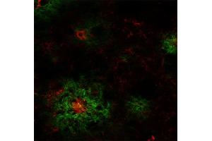 Indirect immunostaining of an PFA fixed section from a 5XFAD mouse with mouse anti-Abeta-pE3, clone 70D7 (dilution 1 : 100; red) and rabbit anti-Abeta (cat. (Abeta-pE3 (AA 3-7) Antikörper)