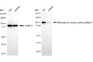 Western blotting analysis using endoplasmic reticulum aminopeptidase 1 antibody (ABIN7798442). (Rekombinanter ERAP1 Antikörper)