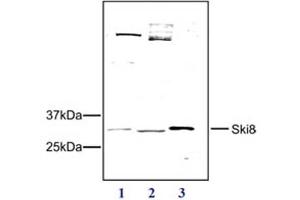 Western Blot of Rabbit anti-SKI8 antibody Western Blot results of Rabbit anti-SKI8 antibody. (WDR61 Antikörper)