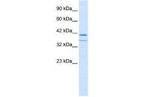 WB Suggested Anti-CEBPB Antibody Titration: 0. (CEBPB Antikörper  (C-Term))