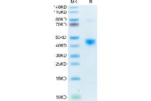 Biotinylated Human LAP (TGF beta 1) on Tris-Bis PAGE under reduced condition. (TGFB1 Protein (AA 30-278) (His-Avi Tag,Biotin))