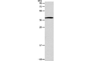 Western blot analysis of Human lymphoma tissue, using SLC25A11 Polyclonal Antibody at dilution of 1:600 (SLC25A11 Antikörper)