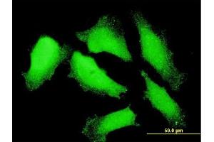 Immunofluorescence of monoclonal antibody to NXT1 on HeLa cell.