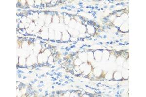 Immunohistochemistry of paraffin-embedded Human colon using NMT1 Polyclonal Antibody at dilution of 1:100 (40x lens). (NMT1 Antikörper)