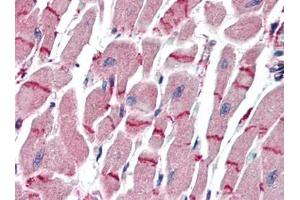 Human Heart (formalin-fixed, paraffin-embedded) stained with APAF1at 10 µg/ml followed by biotinylated goat anti-rabbit IgG secondary antibody, alkaline phosphatase-streptavidin and chromogen. (APAF1 Antikörper  (C-Term))