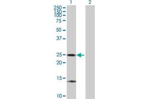 Western Blot analysis of ARHGDIA expression in transfected 293T cell line by ARHGDIA MaxPab polyclonal antibody. (ARHGDIA Antikörper  (AA 1-204))