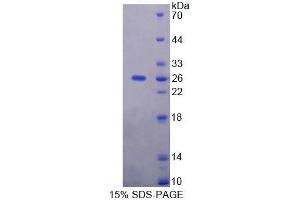 SDS-PAGE (SDS) image for Ninein (GSK3B Interacting Protein) (NIN) (AA 1-153) protein (His tag) (ABIN6239013)