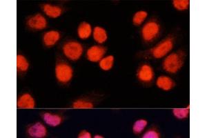 Immunofluorescence analysis of Hela cells using CHAMP1 Polyclonal Antibody at dilution of 1:100 (40x lens). (ZNF828 Antikörper)