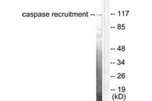 Western blot analysis of extracts from HeLa cells, using CARD6 Antibody. (CARD6 Antikörper  (AA 1-50))