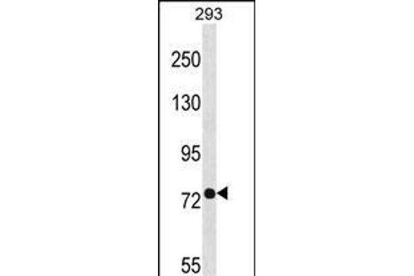 PHEX Antikörper  (C-Term)