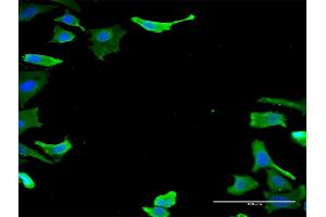 Immunofluorescence of monoclonal antibody to TUBA1B on HeLa cell.