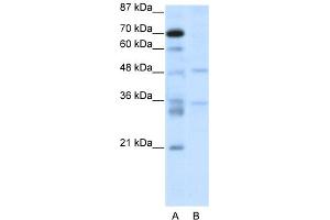 WB Suggested Anti-HTLF Antibody Titration:  2. (FOXN2 Antikörper  (C-Term))