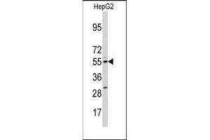 Image no. 1 for anti-Cytochrome P450, Family 11, Subfamily A, Polypeptide 1 (CYP11A1) (N-Term) antibody (ABIN360271)