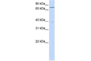 C17ORF80 antibody used at 1 ug/ml to detect target protein. (HLC8 Antikörper  (N-Term))