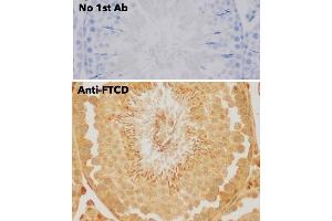 Immunohistochemistry (IHC) image for anti-Formiminotransferase Cyclodeaminase (FTCD) (N-Term) antibody (ABIN6254252) (FTCD Antikörper  (N-Term))
