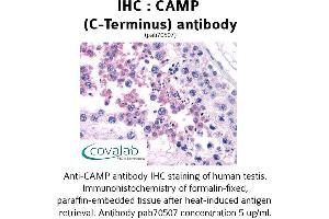 Image no. 1 for anti-Cathelicidin Antimicrobial Peptide (CAMP) (C-Term) antibody (ABIN1732585) (Cathelicidin Antikörper  (C-Term))