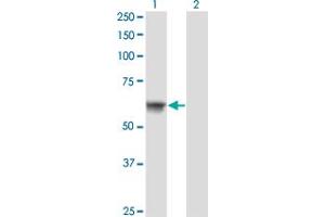 Western Blot analysis of ATP6AP1 expression in transfected 293T cell line by ATP6AP1 monoclonal antibody (M02), clone 3B11. (ATP6AP1 Antikörper  (AA 51-150))