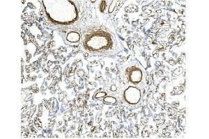 IHC analysis of CD146/MCAM using anti-CD146/MCAM antibody (ABIN7602098).