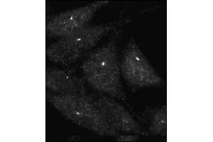 Immunofluorescence staining of Autophagy UVRAG antibody (ABIN388586 and ABIN2849984) on Methanol-fixed HeLa cells. (UVRAG Antikörper  (C-Term))